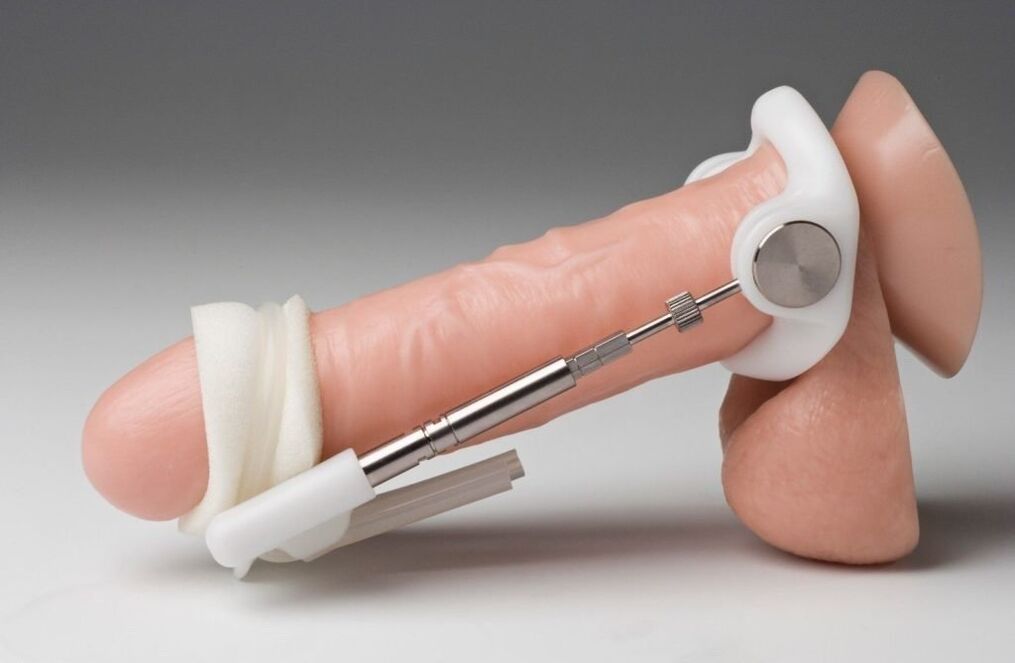 Extender to increase penis thickness